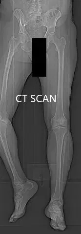 Imágenes topológicas por tomografía computarizada preoperatoria  