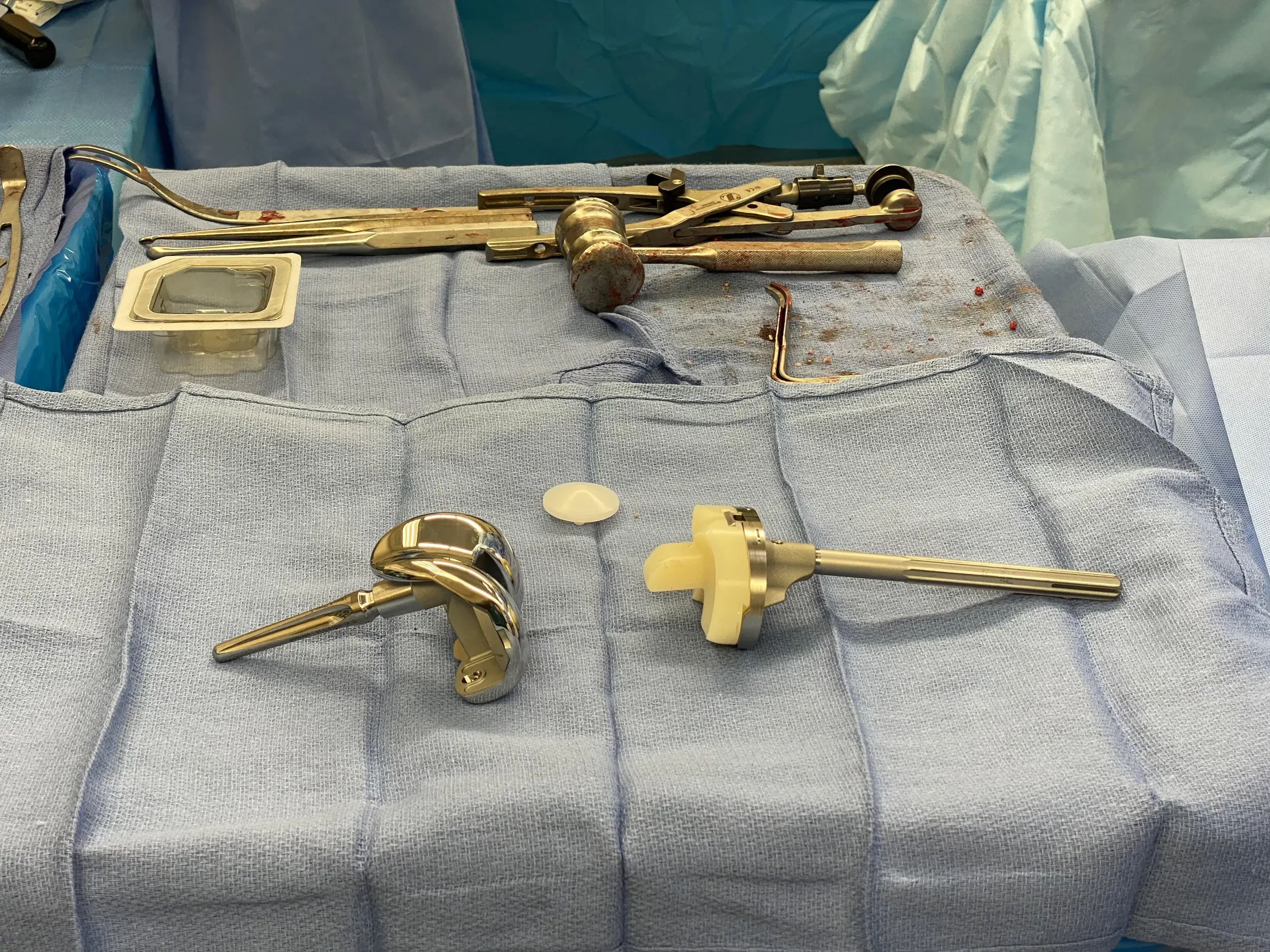 Revision knee replacement implant (semi - constrained with a long stem)