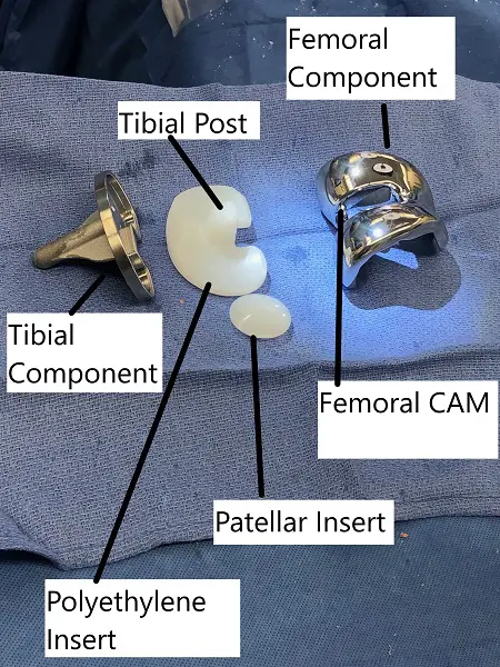 Knee replacement parts