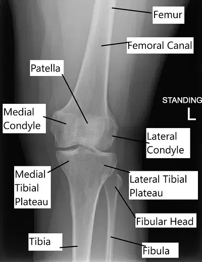 Radiografía que muestra anatomía de rodilla.