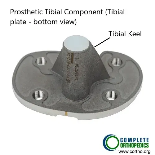 Componente tibial (superficie inferior)