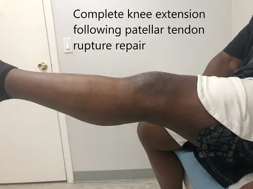 Postoperative images at 2 months follow up.