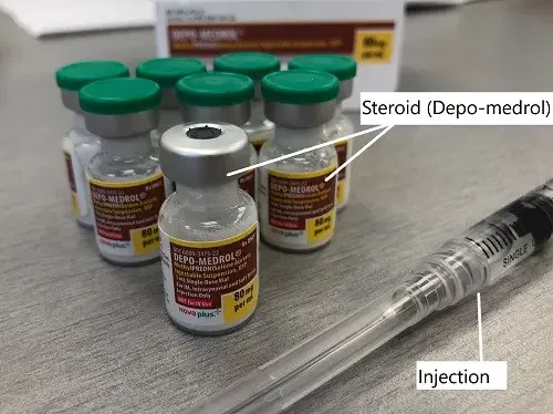 Depo-Medrol se usó como inyección de corticoides en la inyección de cortisona.