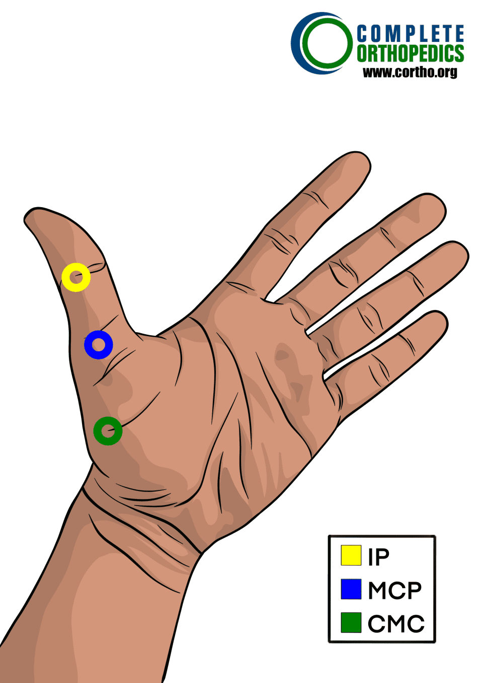 articulación metacarpopfalángica e interfalángica interfalángica distal proximal del pulgar para evaluar la pérdida de movimiento y calcular la pérdida de uso programada para pacientes de compensación laboral