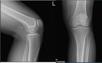 AP y Vista de Latera