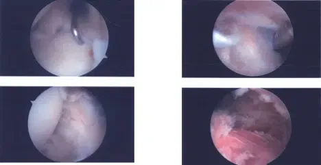 Documentación de imágenes