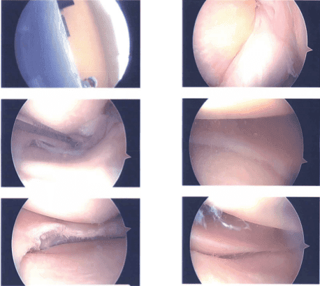 Imágenes intraoperatorias