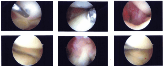 Intraoperative Images