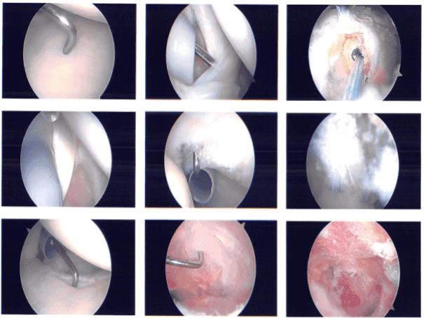 Imágenes intraoperatorias