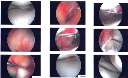 Imágenes intraoperatorias