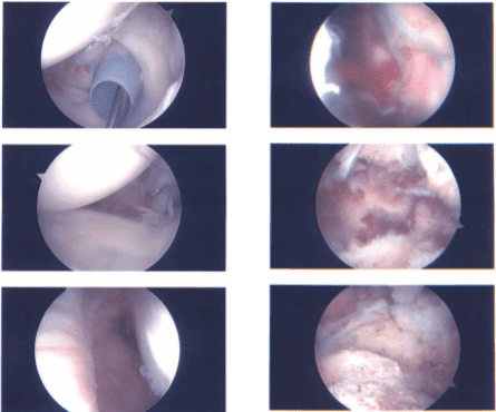 Intraoperative report