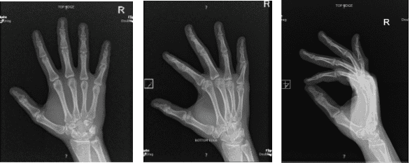 X-ray Right hand minimum 3 years