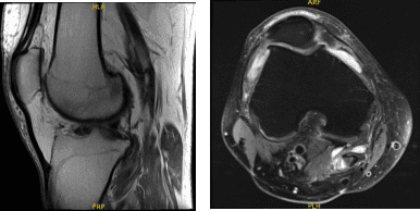 maldijo las opciones de tratamiento y o