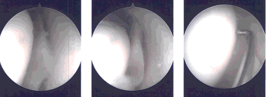 Imágenes intraoperatorias