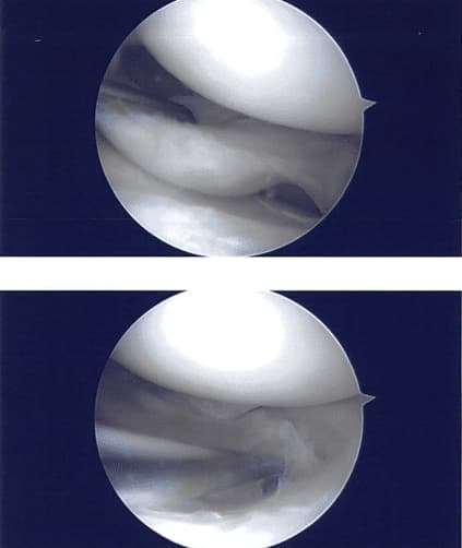 Intraoperative images