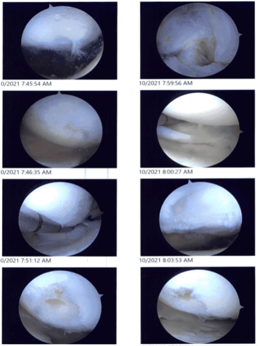 Intraoperative images