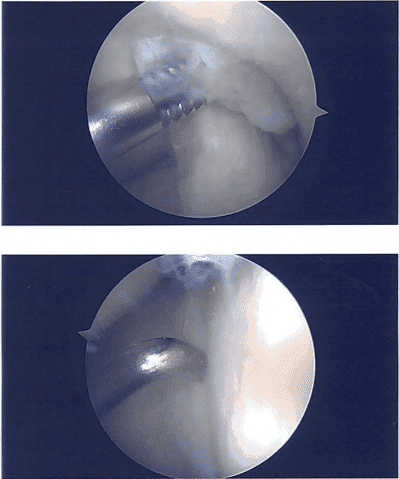 Imágenes intraoperatorias