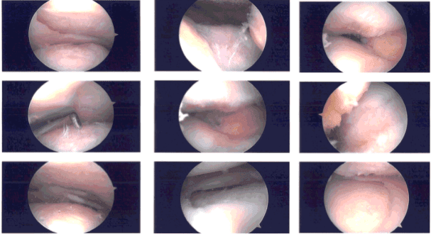 Imágenes intraoperatorias