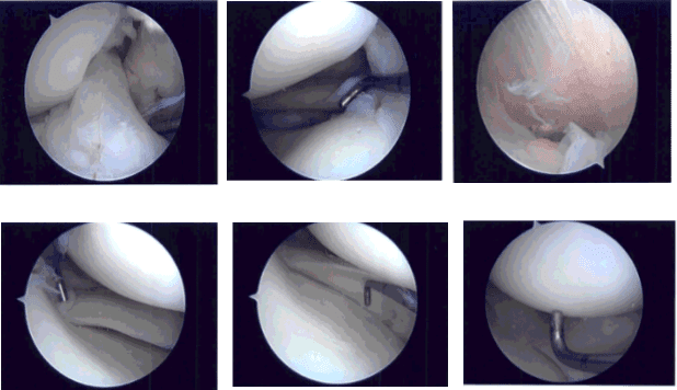 Foto intraoperatoria