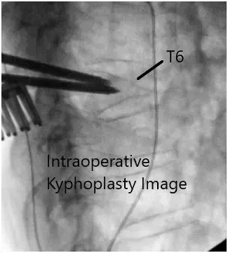 Imágenes de fluoroscopia intraoperatoria