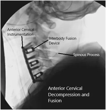 Imágenes fluoroscópicas intraoperatorias 2