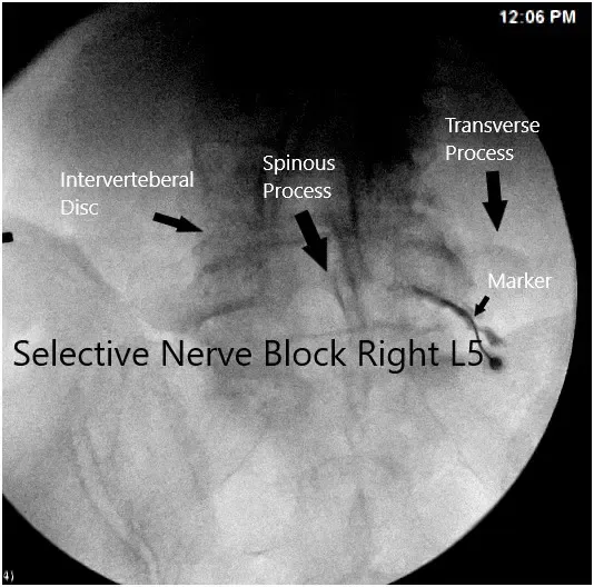 Imagen fluoroscópica intraoperatoria