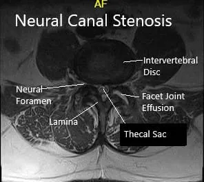 MRI showing sagittal and axial sections 2