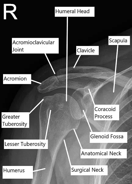 Radiografía que muestra la anatomía normal del hombro
