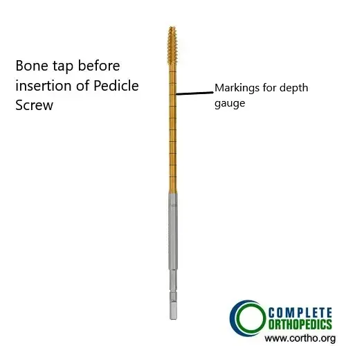 Bone tap