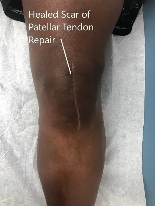 Postoperative images at 2 months follow up.