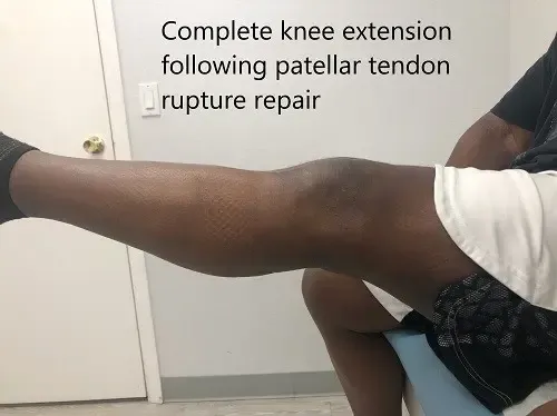 Postoperative images at 2 months follow up.