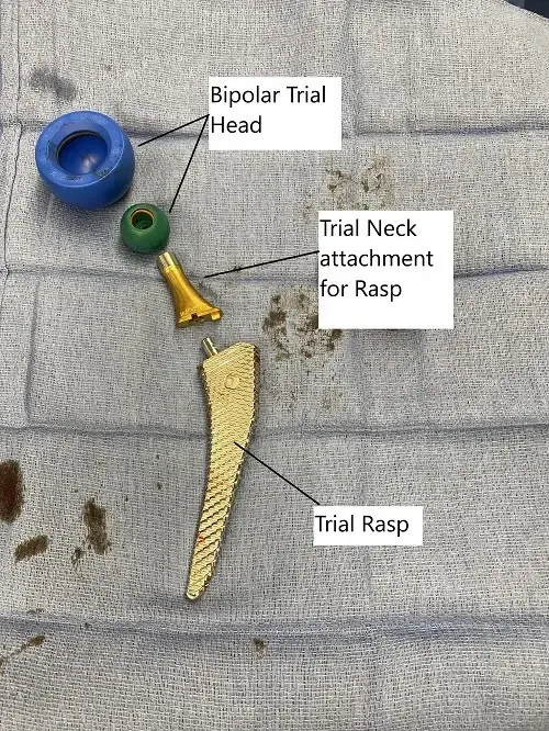 Intraoperative image of total hip replacement.