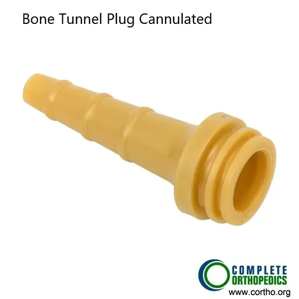 Tapón de túnel óseo utilizado en la reconstrucción del LCA.