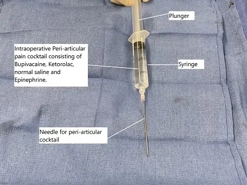 Intraoperative cocktail for peri-articular injection used for pain control after the surgery.