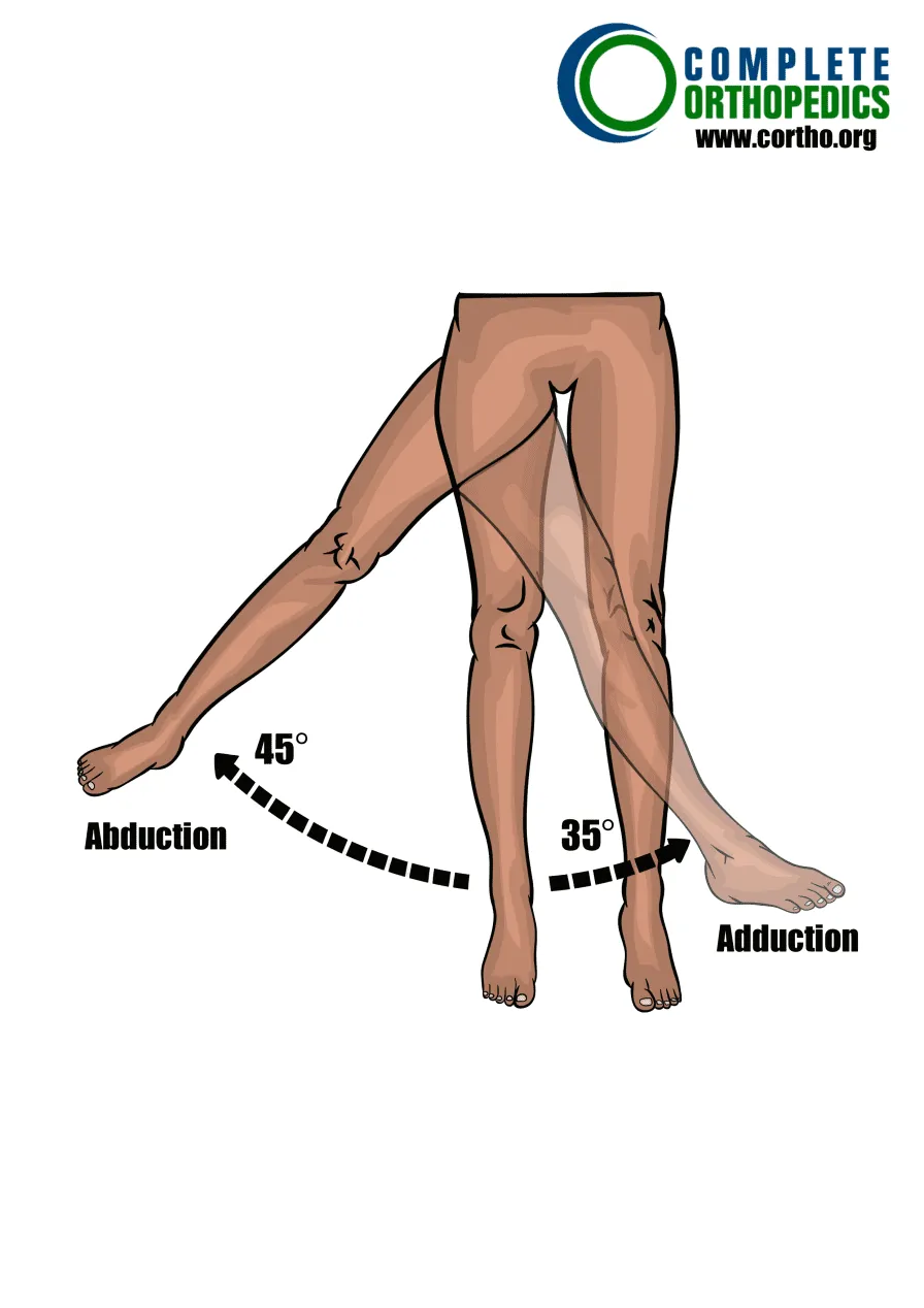 Abducción y aducción de cadera para evaluar la pérdida de movimiento y calcular la pérdida de uso programada para pacientes de compensación laboral