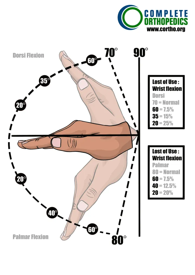 Dorsi-flexion-and-Palmar-flexion-of wrist to evaluate loss of motion to calculate scheduled loss of use for workers compensation patient