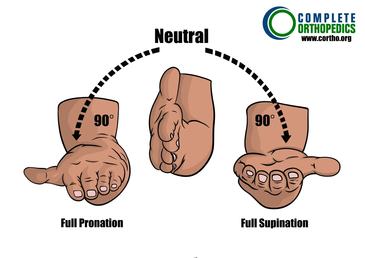 Pronation-–-Supination-of-the-Wrist to evaluate loss of motion to calculate scheduled loss of use for workers compensation patient
