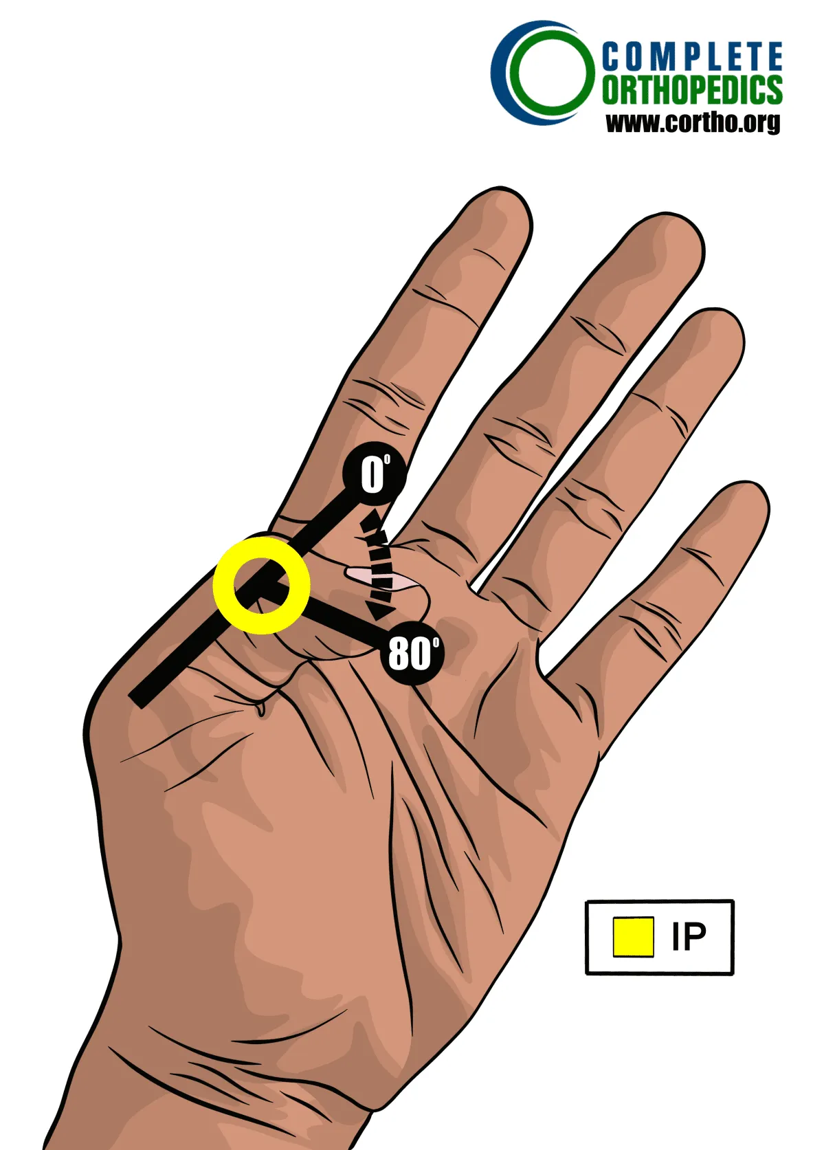 interphalangeal joint of thumb to evaluate loss of motion to calculate scheduled loss of use for workers compensation patient