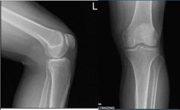 AP y Vista de Latera