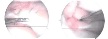 Final pictures showing operative part dressed