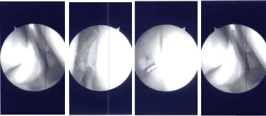Intraoperative Arthroscopy Images