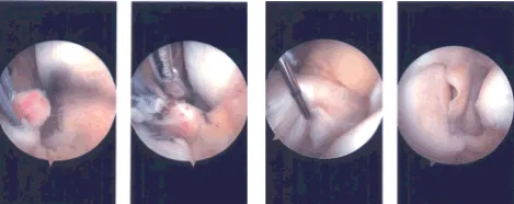 Intraoperative Arthroscopy Images