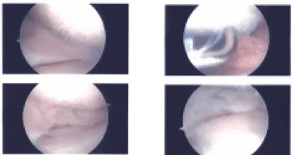 Imágenes intraoperatorias