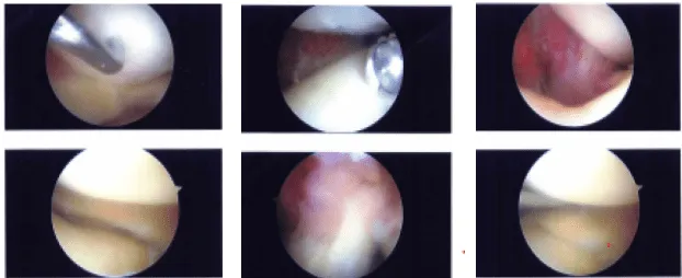 Imágenes intraoperatorias