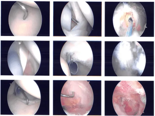Intraoperative images