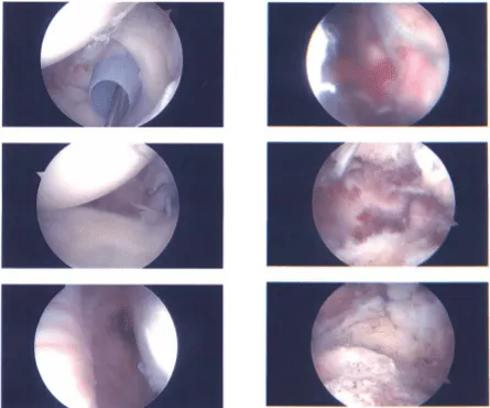 Intraoperative report