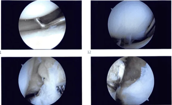 Introperative images