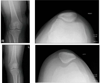 Radiografía de rodilla con rótula