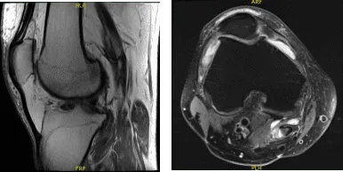 cussed the treatment options and o