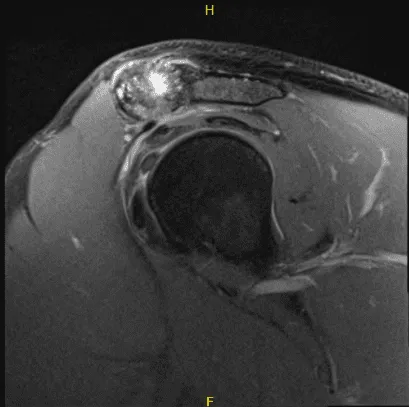 Intraoperative Arthroscopy Images